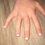 Medische manicure Mechelen